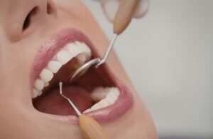 Lee más sobre el artículo Cómo mejorar la sonrisa: tratamientos de estética dental en Madrid