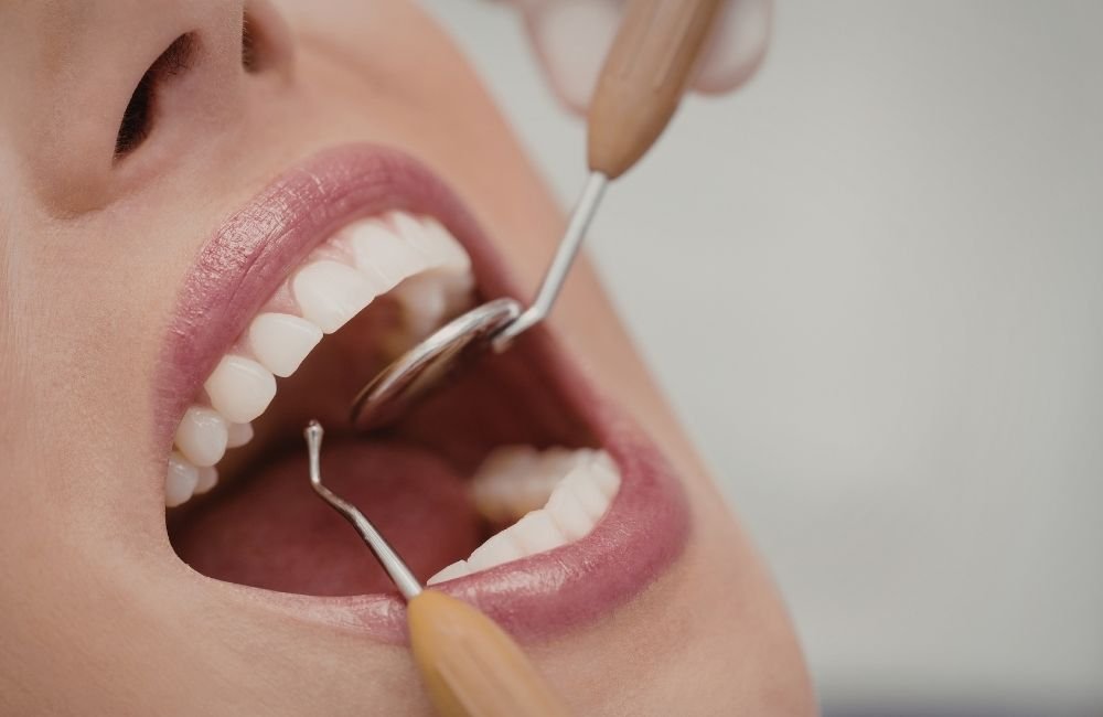 Lee más sobre el artículo Cómo mejorar la sonrisa: tratamientos de estética dental en Madrid